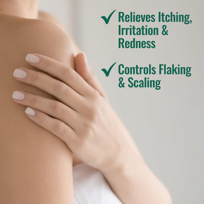 Nizoral Psoriasis Relief Cream, Maximum Strength, 4 Fl Oz, Relieves Itching, Irritation & Redness, Controls Flaking and Scaling, Salicylic Acid 3%