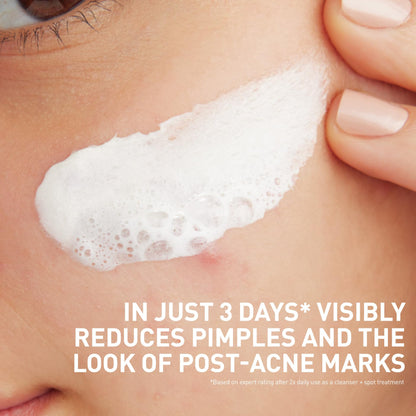 CeraVe Clay to Foam Acne Face Wash, Salicylic Acid Spot Treatment, 4 Oz